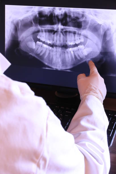 Best Emergency Dental Care for Abscessed Tooth in Licking, MO