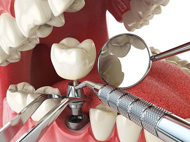 Best Weekend Emergency Dentist in Licking, MO